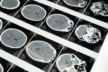 Brain scans by pexels-cottonbro-5723883